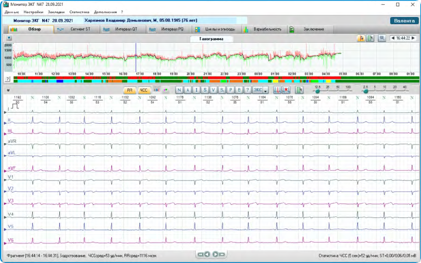Холтер ЭКГ Валента 12-ти канальный Santreyd MED-37 - Вид №2