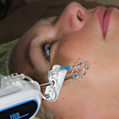 24420 Косметологический аппарат мезоинжектор NV-919 Meso Gun Nova NewFace (НОВА НьюФейс)  - Вид №4