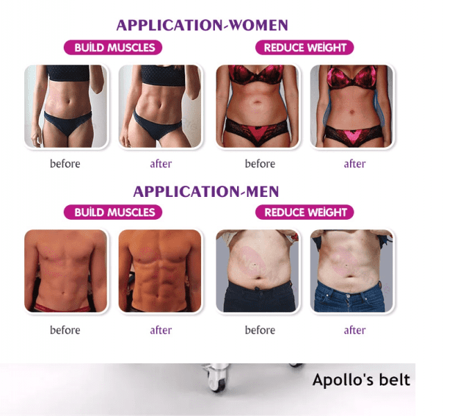 52442 Аппарат миостимуляции HI-EMT BODYSCULPT AURO  - Вид №15